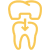Implantes Dentários